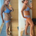 Отзыв о Абдоминопластика: Баков Вадим Сергеевич!!!
